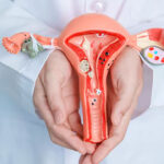 Investigadores recomiendan alternativas a la histerectomía para los fibromas uterinos