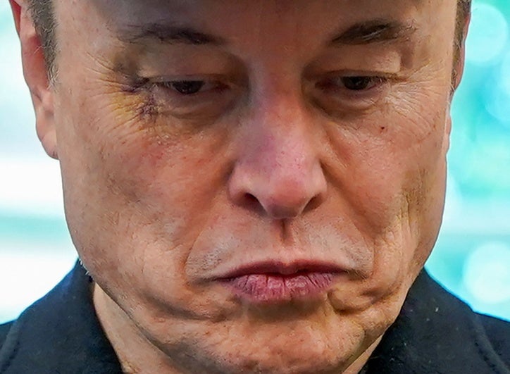 Musk desvela que tiene un ojo morado porque su hijo le pegó