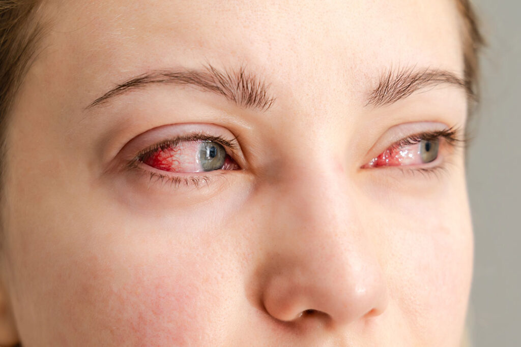 ¿Te arden los ojos? El polvo del Sahara y el calor podrían ser los culpables